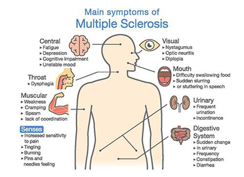 multiple-sclerosis